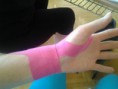 /album/fotogalerie-kineziotaping/a2014-05-25-15-49-05-jpg1/